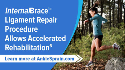 The InternalBrace™ procedure augments the primary surgical repair using special anchors to provide additional points of fixation that hold the ligament to a patient’s ankle bone while they heal.