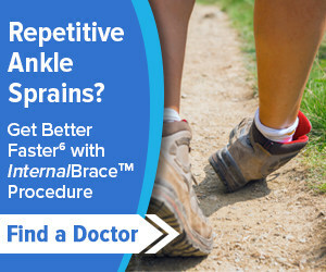 The InternalBrace™ technique was initially developed to support lateral ankle instability repair during the post-surgery healing phase. This procedure restores strength and stability to a patient’s chronically sprained ankle.