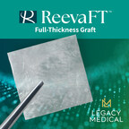 Legacy Medical Consultants Announces Reeva FT™, a Full-Thickness Allograft for Wound Covering and Protection During Treatment