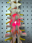 Red light therapy for repairing spinal cord injury passes milestone