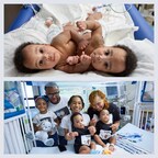 Children’s Hospital of Philadelphia Successfully Separates Conjoined Twin Boys